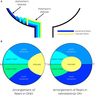 Patterns of Retinal Ganglion Cell Damage in Neurodegenerative Disorders: Parvocellular vs Magnocellular Degeneration in Optical Coherence Tomography Studies